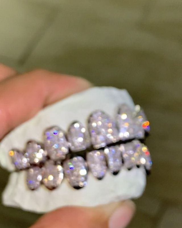 Customer from Little Rock Arkansas is coming down to get 20 teeth Vvs1 clarity F color diamonds perm