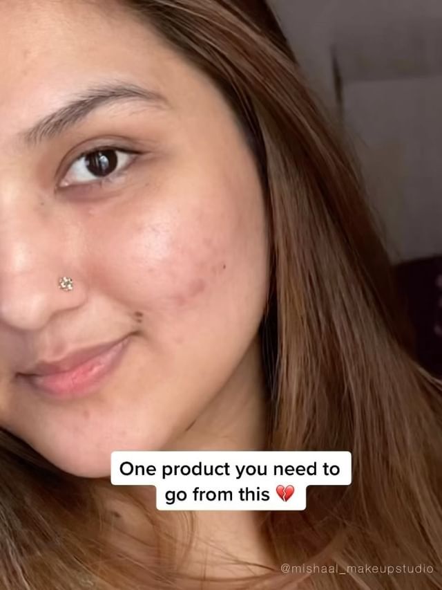 Only one product you need âœ¨ conatural  super active niacinamide serum 
.
Im just in love with this