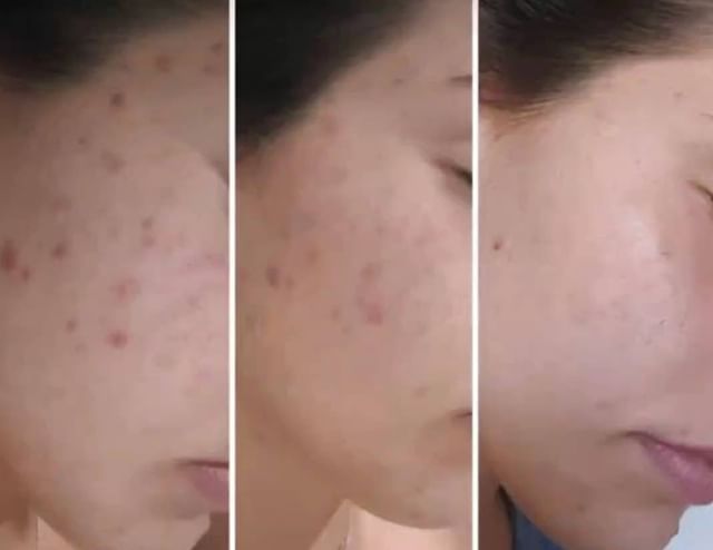 Super affordable and best vitamin C serum. Visibly brightens and deliver firmer, even toned, glowy s